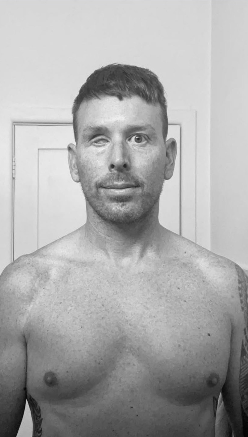 Black and white portrait of Phillipe Cossey showing his prosthetic eye